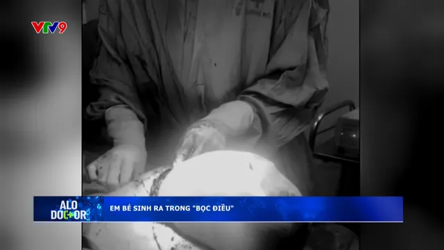 Alo Doctor (23/9/2025): Em bé sinh ra trong "bọc điều"