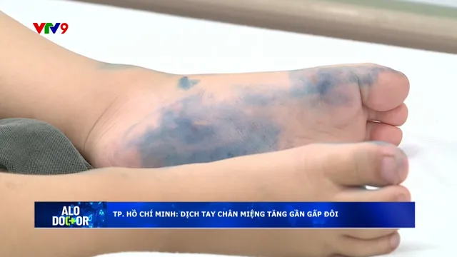 Alo Doctor (103/10/2025): TP. Hồ Chí Minh dịch tay chân miệng tăng gấp đôi