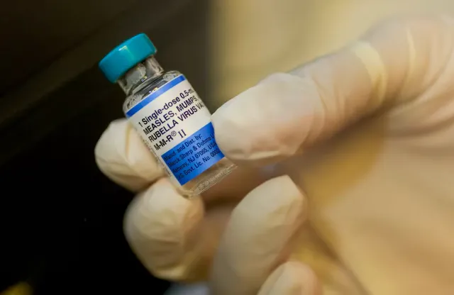 Giới chức y tế Mỹ kêu gọi tách riêng mũi vaccine kết hợp sởi, quai bị và Rubella- Ảnh 1. Giới chức y tế Mỹ kêu gọi tách riêng mũi vaccine kết hợp sởi, quai bị và Rubella- Ảnh 1.