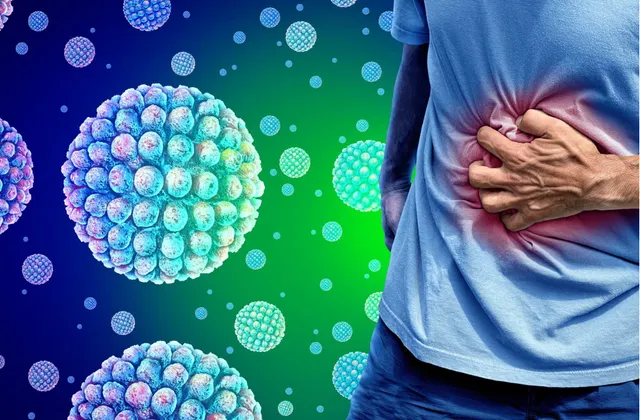 Số ca nhiễm Norovirus ở Mỹ tăng gấp 2 lần - Ảnh 1.