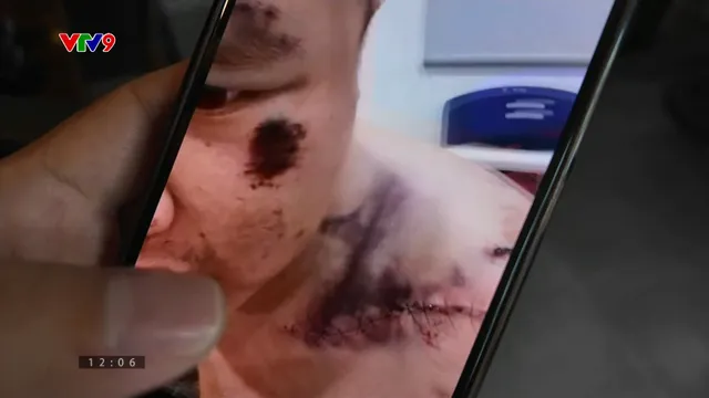 Sống trong địa ngục trần gian