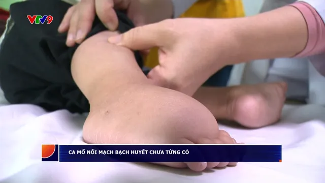 Ca mổ nối bạch huyết chưa từng có