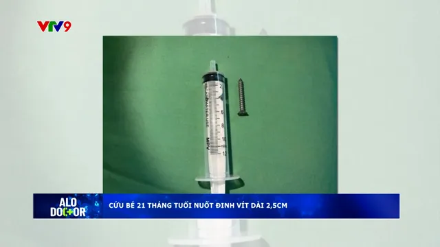 Alo Doctor (16/4/2026): Cứu bé 21 tháng tuổi nuốt đinh vít dài 2,5cm