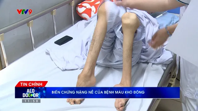 Alo Doctor (25/4/2026): Biến chứng nặng nề của bệnh máu khó đông