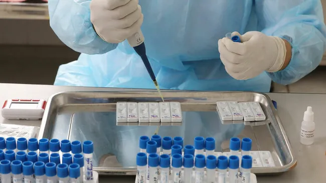 A medical staff tests samples of people for the novel coronavirus in Hanoi. (Photo: VnExpress)