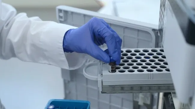 A medical worker gets health check before vaccination (Photo VNA)