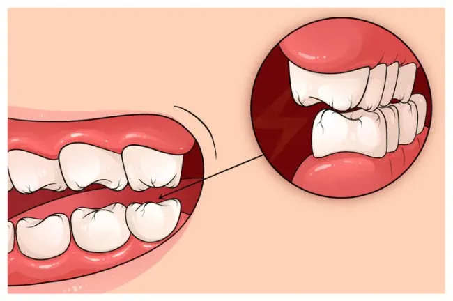 Căng thẳng âm thầm hủy hoại cơ thể bạn thế nào mà không ai ngờ tới?