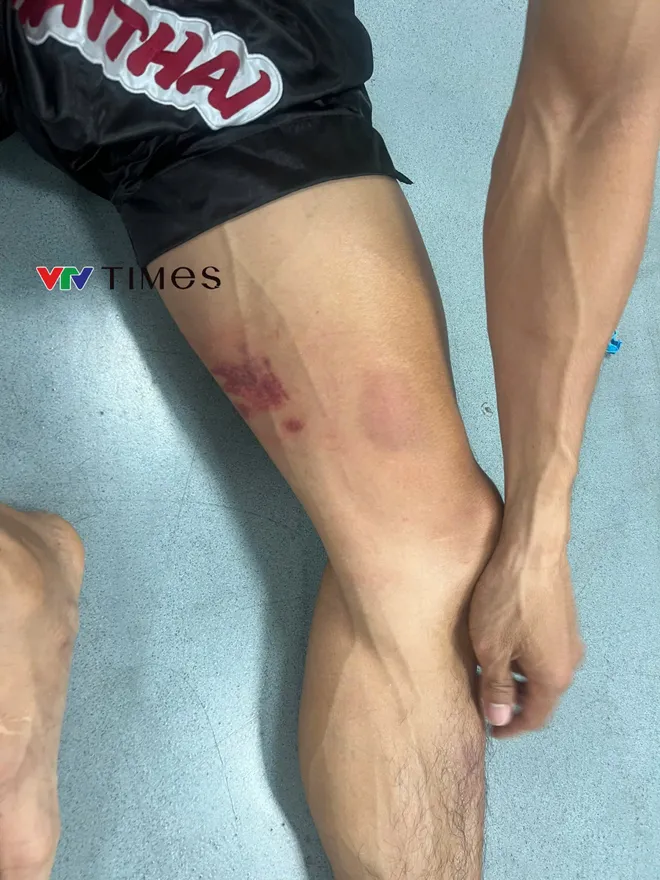 Nguyễn Trần Duy Nhất: "Ông già" 36 tuổi vẫn xỏ găng và hình mẫu truyền lửa cho thế hệ trẻ- Ảnh 3.