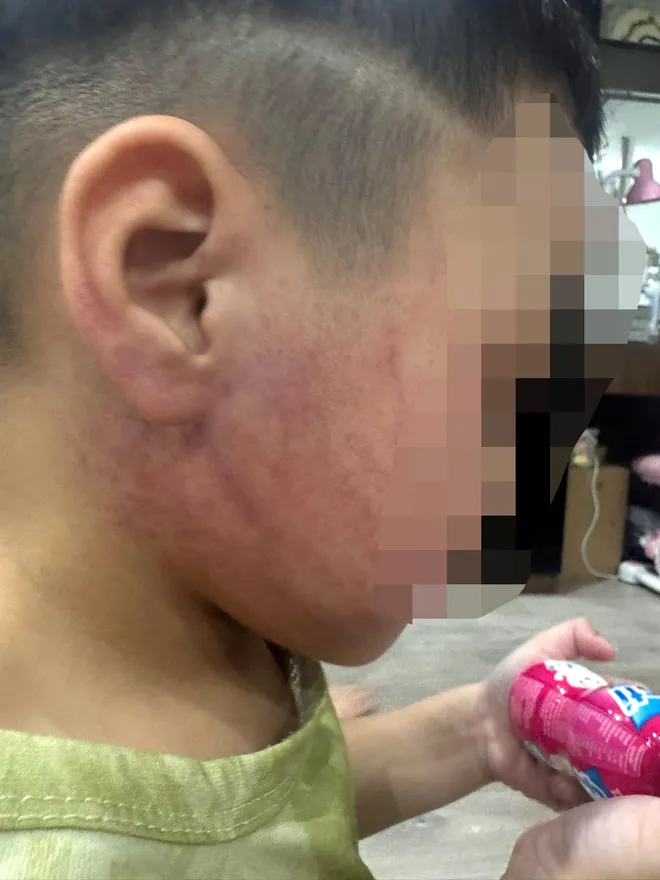 Bé 4 tuổi nghi bị giáo viên mầm non bạo hành, công an khẩn trương vào cuộc - Ảnh 3.