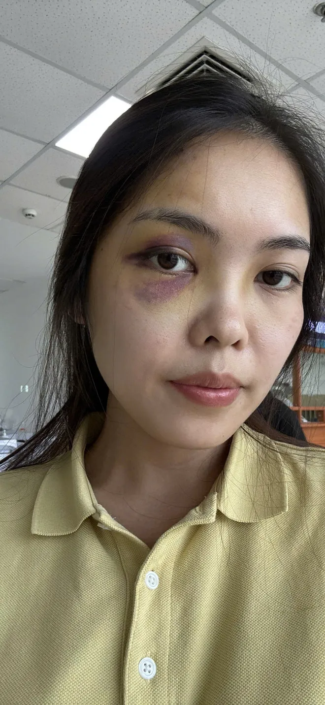 Người mẹ hai con ở Hà Nội trình báo bị chồng hành hung tại chung cư - Ảnh 1.