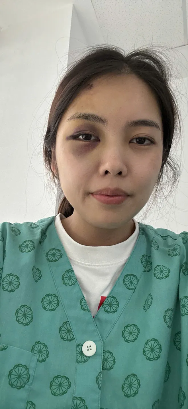 Người mẹ hai con ở Hà Nội trình báo bị chồng hành hung tại chung cư - Ảnh 3.