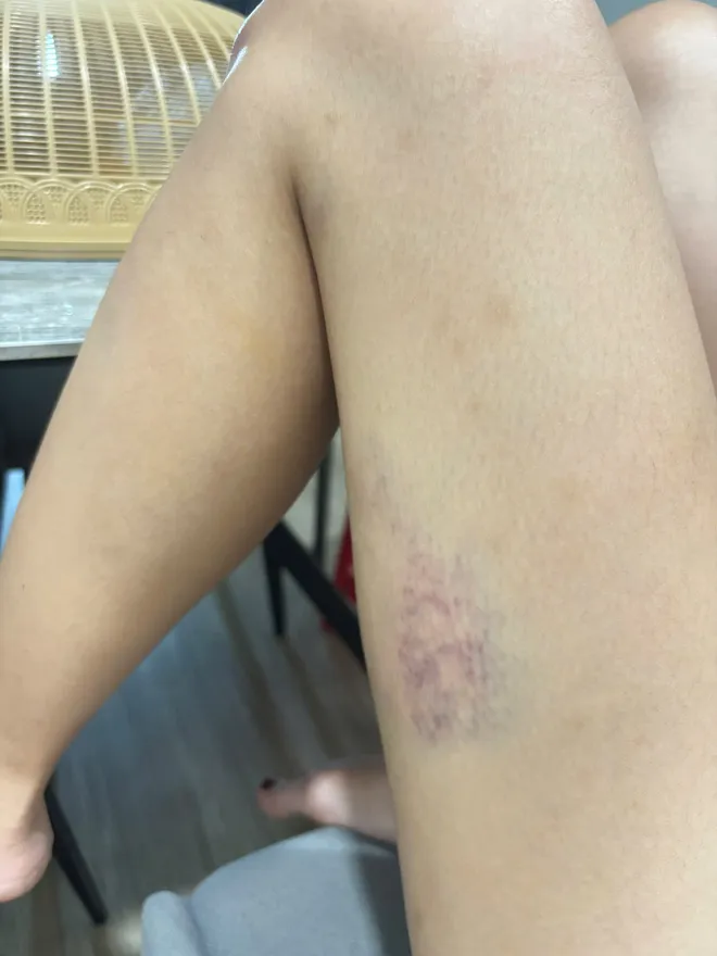 Người mẹ hai con ở Hà Nội trình báo bị chồng hành hung tại chung cư - Ảnh 5.