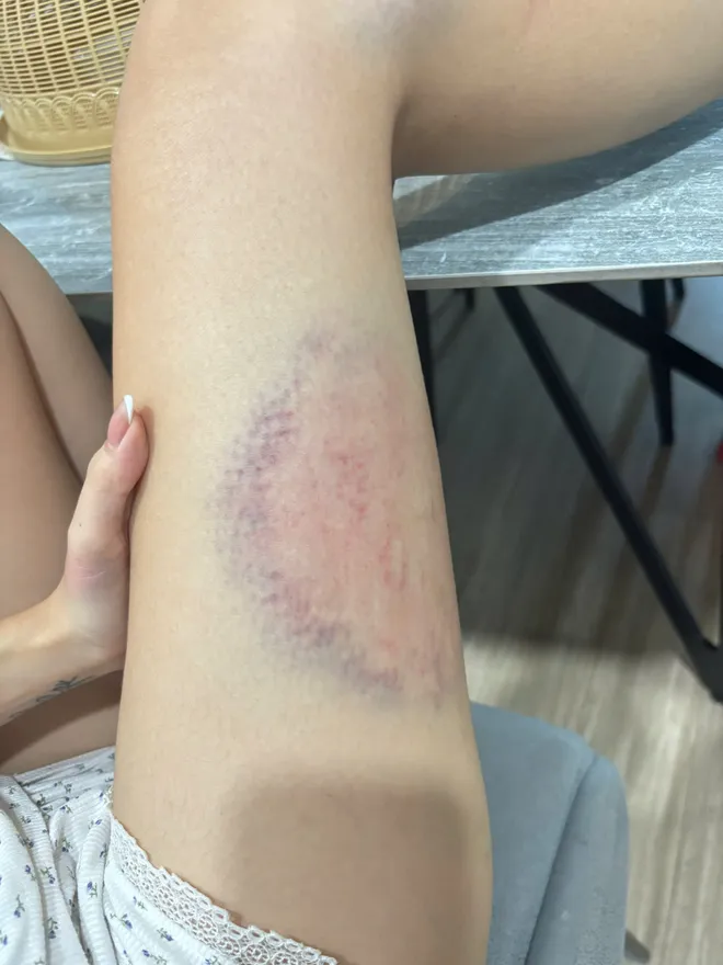 Người mẹ hai con ở Hà Nội trình báo bị chồng hành hung tại chung cư - Ảnh 6.