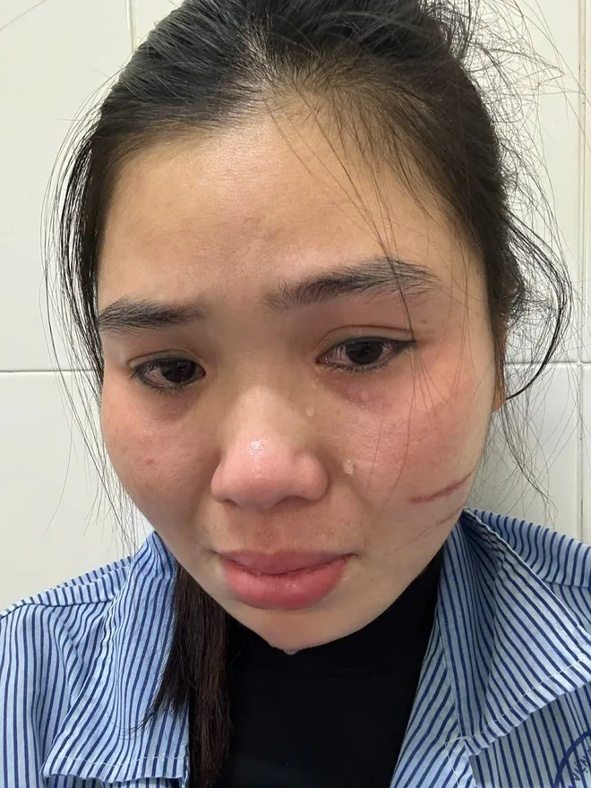 Người phụ nữ ở Hà Nội tố bị đôi nam nữ xông vào nhà hành hung, phải nhập viện điều trị - Ảnh 3.