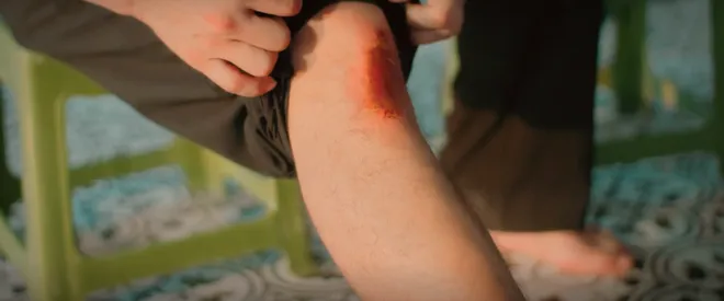 Đồng hồ đếm ngược - Tập 1: Th&agrave;nh "ngẫn" cứu ch&oacute; Coddy từ l&ograve; mổ, vận may bắt đầu đến- Ảnh 15.