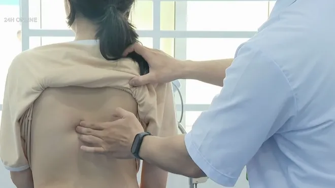 Báo động gia tăng bệnh gù vẹo cột sống học đường trong dịp hè- Ảnh 2. Báo động gia tăng bệnh gù vẹo cột sống học đường trong dịp hè- Ảnh 2.