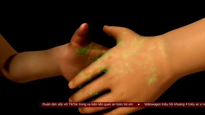 Lần đầu tiên Việt Nam có vắc xin phòng tay chân miệng- Ảnh 2. Lần đầu tiên Việt Nam có vắc xin phòng tay chân miệng- Ảnh 2.