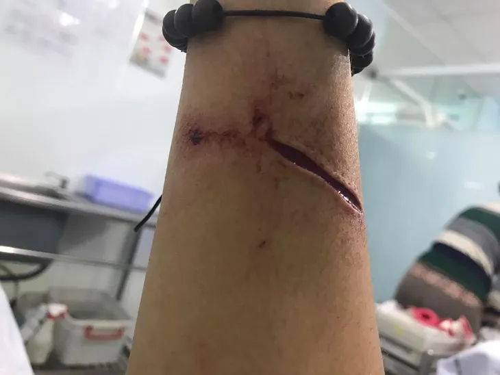 Xé lòng với lời cầu xin của ca sĩ Đông Hùng: Con mệt rồi mẹ ạ. Cho con một con đường sống! - Ảnh 1. Xé lòng với lời cầu xin của ca sĩ Đông Hùng: Con mệt rồi mẹ ạ. Cho con một con đường sống! - Ảnh 1.