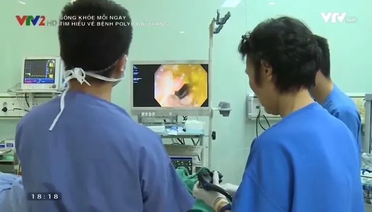 Đối tượng nào dễ mắc polyp đại tràng? - Ảnh 1. Đối tượng nào dễ mắc polyp đại tràng? - Ảnh 1.