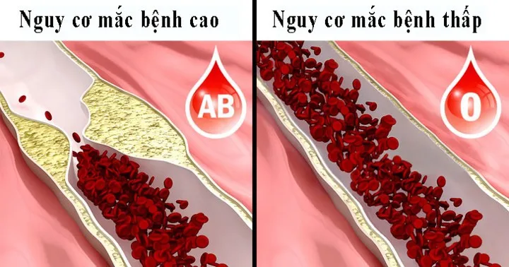 8 điều người nhóm máu O nên biết - Ảnh 6. 8 điều người nhóm máu O nên biết - Ảnh 6.