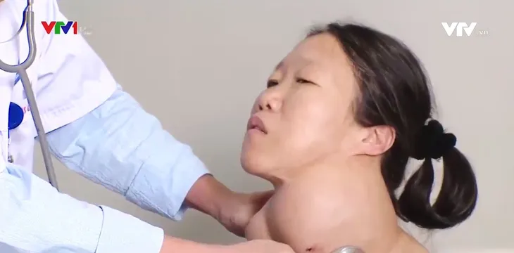 BV Nội tiết TƯ phẫu thuật thành công khối u tuyến giáp khổng lồ - Ảnh 1. BV Nội tiết TƯ phẫu thuật thành công khối u tuyến giáp khổng lồ - Ảnh 1.