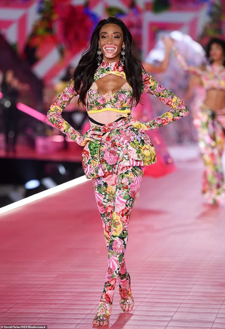Siêu mẫu bạch tạng Winnie Harloe nổi bật tại Victorias Secret Fashion Show 2018 - Ảnh 3. Siêu mẫu bạch tạng Winnie Harloe nổi bật tại Victorias Secret Fashion Show 2018 - Ảnh 3.