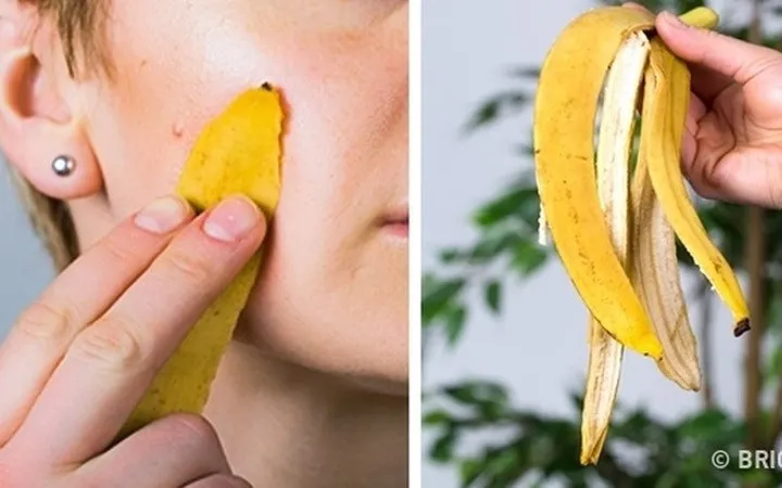 Khám phá công dụng làm đẹp không ngờ bằng vỏ chuối - Ảnh 3. Khám phá công dụng làm đẹp không ngờ bằng vỏ chuối - Ảnh 3.