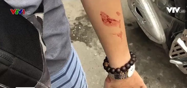Giám đốc Trung tâm gia sư dùng dao dọa giết hai sinh viên - Ảnh 3. Giám đốc Trung tâm gia sư dùng dao dọa giết hai sinh viên - Ảnh 3.