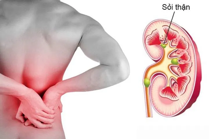 Uống nước sau khi thức dậy, điều tuyệt vời sẽ xảy ra - Ảnh 7. Uống nước sau khi thức dậy, điều tuyệt vời sẽ xảy ra - Ảnh 7.