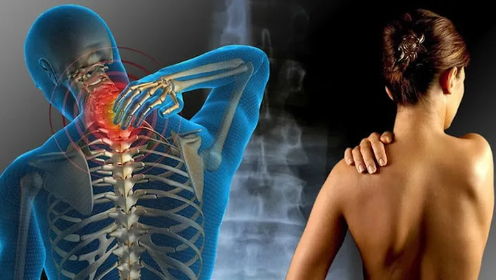 8 nguy cơ sức khỏe liên quan đến chứng đau nửa đầu - Ảnh 3. 8 nguy cơ sức khỏe liên quan đến chứng đau nửa đầu - Ảnh 3.