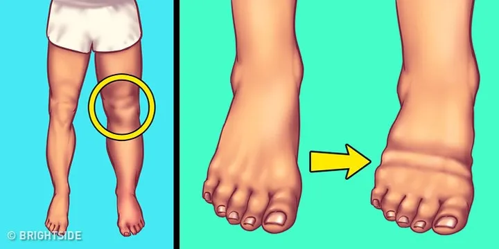7 dấu hiệu bạn đang ăn quá nhiều muối - Ảnh 1. 7 dấu hiệu bạn đang ăn quá nhiều muối - Ảnh 1.