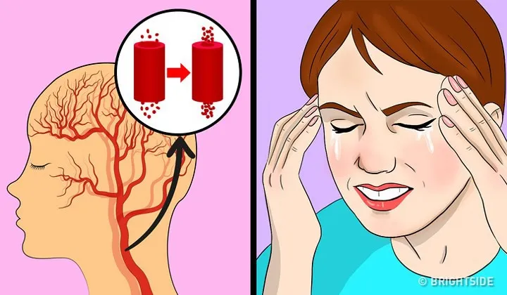 7 dấu hiệu bạn đang ăn quá nhiều muối - Ảnh 6. 7 dấu hiệu bạn đang ăn quá nhiều muối - Ảnh 6.