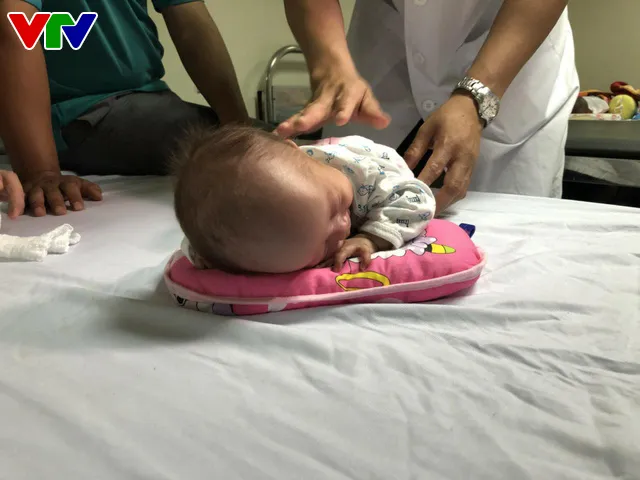 Hạnh phúc vỡ òa bé sinh non 500gram phát triển kỳ diệu sau 4 tháng nuôi lồng ấp - Ảnh 5. Hạnh phúc vỡ òa bé sinh non 500gram phát triển kỳ diệu sau 4 tháng nuôi lồng ấp - Ảnh 5.