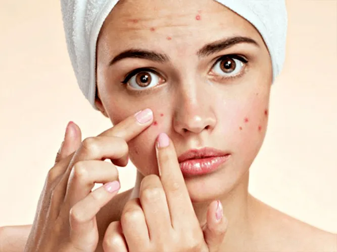 Mách bạn cách chăm sóc da cực kỳ đơn giản lại không tốn kém - Ảnh 3. Mách bạn cách chăm sóc da cực kỳ đơn giản lại không tốn kém - Ảnh 3.