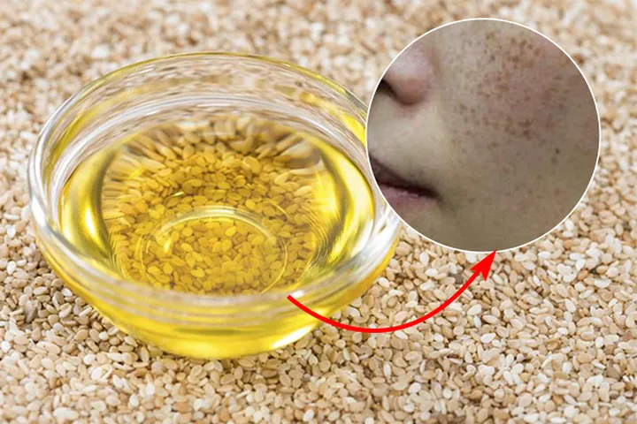 Mách bạn cách chăm sóc da cực kỳ đơn giản lại không tốn kém - Ảnh 4. Mách bạn cách chăm sóc da cực kỳ đơn giản lại không tốn kém - Ảnh 4.