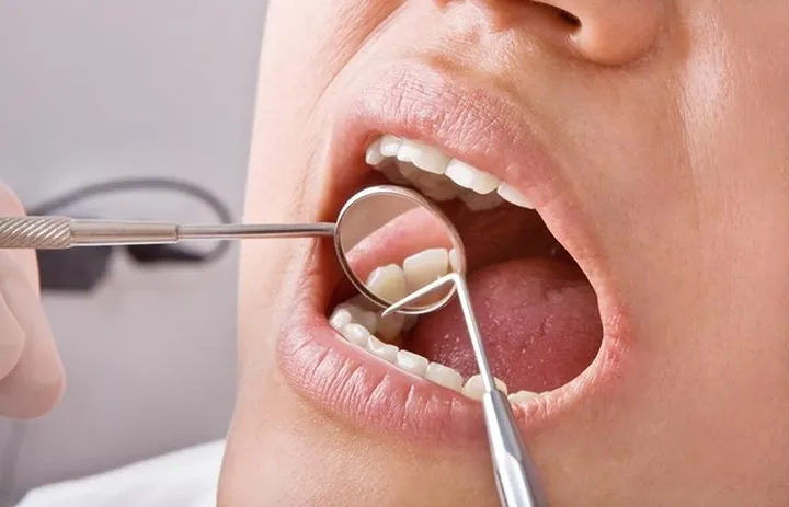 Tác dụng phụ nghiêm trọng nếu uống quá nhiều nước chanh - Ảnh 1. Tác dụng phụ nghiêm trọng nếu uống quá nhiều nước chanh - Ảnh 1.