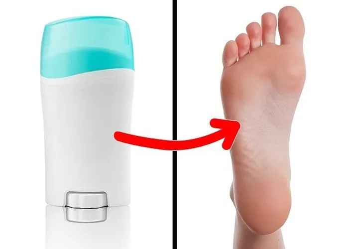 Các biện pháp khắc phục mùi hôi chân rất dễ dàng - Ảnh 4.