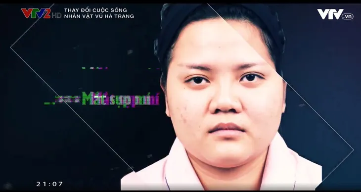 Change Life 2018: Nữ ca sĩ 74 kg lột xác sau phẫu thuật thẩm mỹ - Ảnh 4. Change Life 2018: Nữ ca sĩ 74 kg lột xác sau phẫu thuật thẩm mỹ - Ảnh 4.