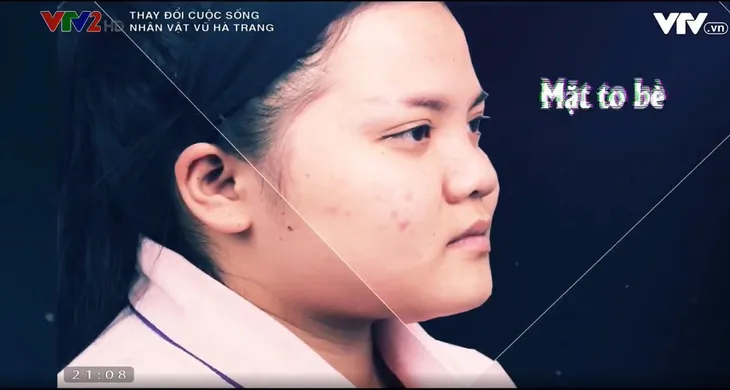 Change Life 2018: Nữ ca sĩ 74 kg lột xác sau phẫu thuật thẩm mỹ - Ảnh 3. Change Life 2018: Nữ ca sĩ 74 kg lột xác sau phẫu thuật thẩm mỹ - Ảnh 3.