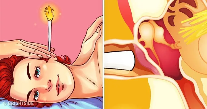 8 phương pháp điều trị bệnh tại nhà có thể khiến bạn gặp nguy hiểm - Ảnh 6. 8 phương pháp điều trị bệnh tại nhà có thể khiến bạn gặp nguy hiểm - Ảnh 6.