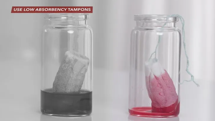 Sốc độc tố vì dùng tampon gây nhiễm trùng máu - Ảnh 1.