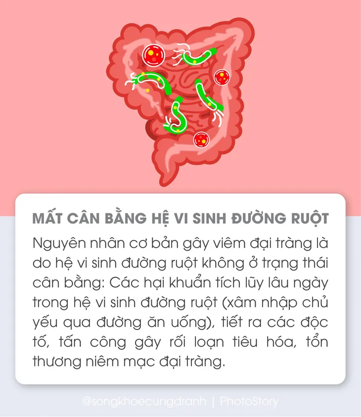 5 nguyên nhân phổ biến gây viêm đại tràng - Ảnh 1. 5 nguyên nhân phổ biến gây viêm đại tràng - Ảnh 1.