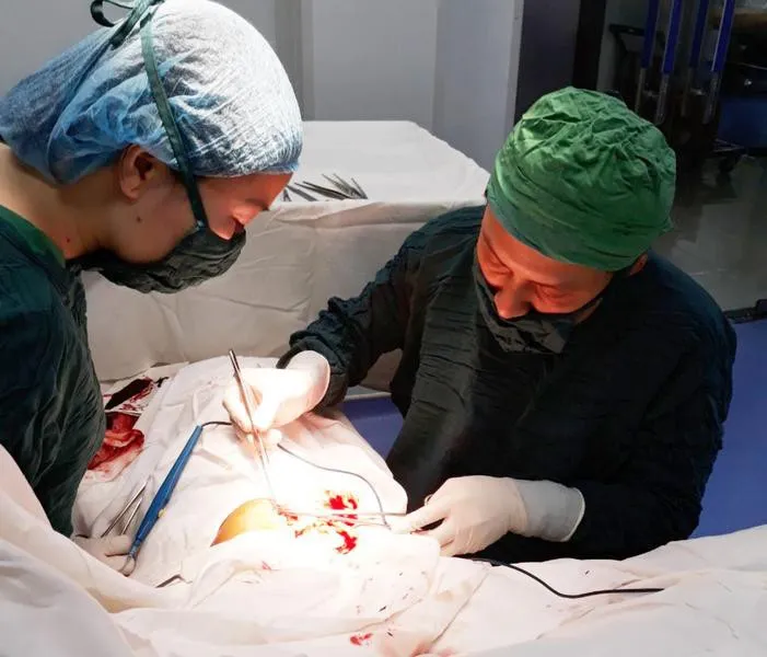 Ngã lúc trèo thang, người đàn ông bị cọc tre đâm thủng tay - Ảnh 1. Ngã lúc trèo thang, người đàn ông bị cọc tre đâm thủng tay - Ảnh 1.