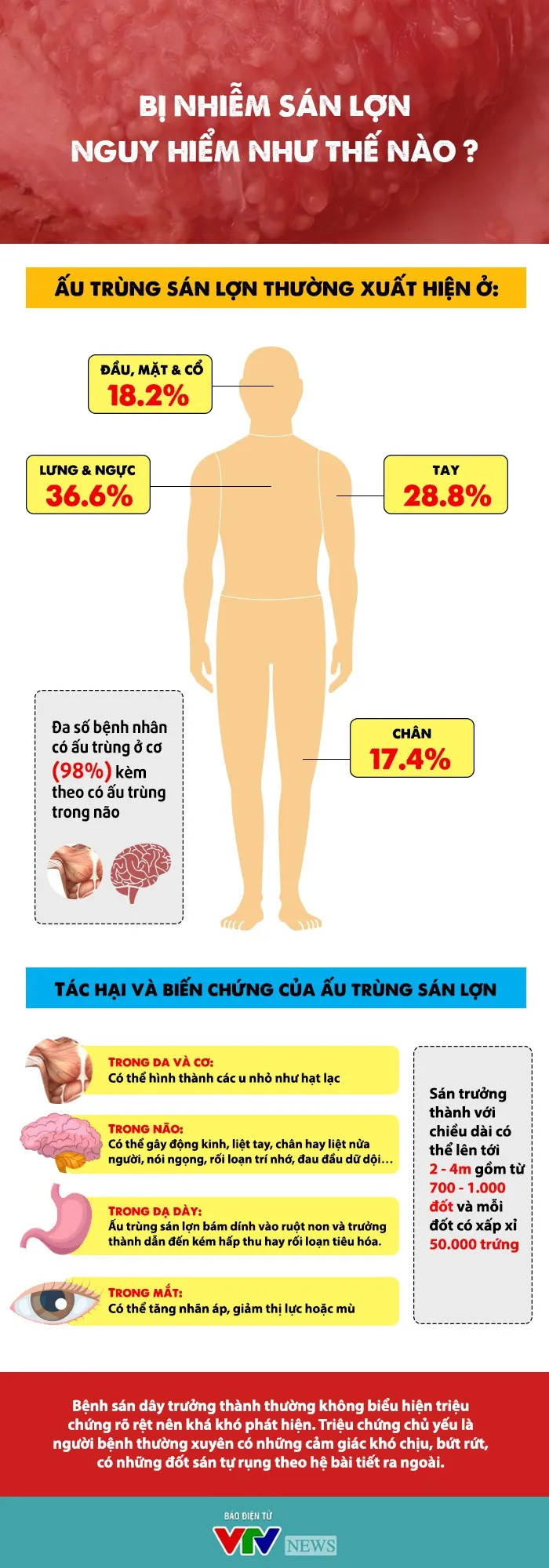 Bị nhiễm sán lợn nguy hiểm như thế nào? - Ảnh 1. Bị nhiễm sán lợn nguy hiểm như thế nào? - Ảnh 1.