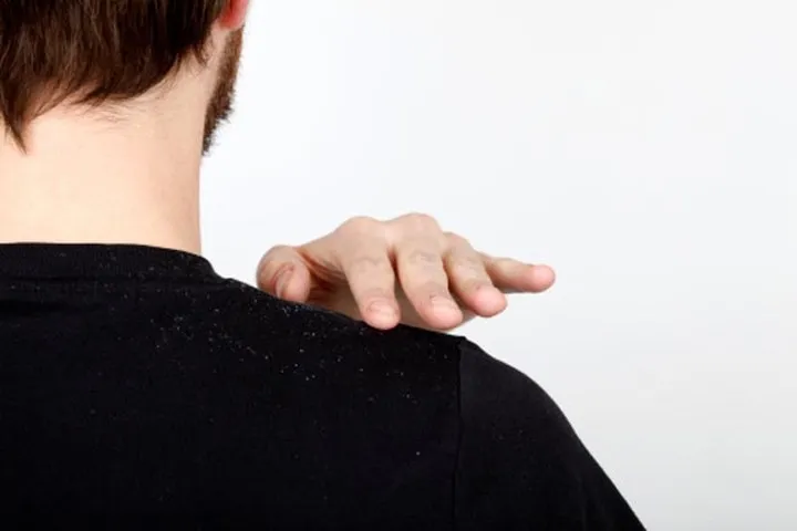 Nhận biết tình trạng sức khỏe của bạn qua mái tóc - Ảnh 2. Nhận biết tình trạng sức khỏe của bạn qua mái tóc - Ảnh 2.