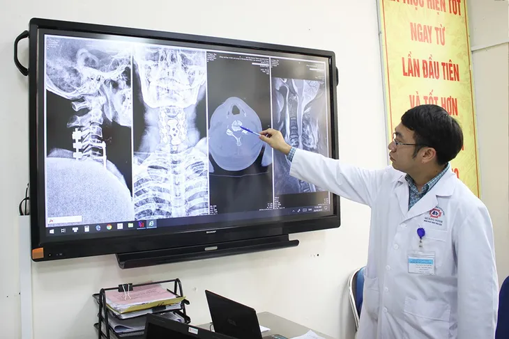 Kết hợp 2 đường mổ phức tạp cứu bệnh nhân vỡ dập tủy cổ, liệt tứ chi - Ảnh 1. Kết hợp 2 đường mổ phức tạp cứu bệnh nhân vỡ dập tủy cổ, liệt tứ chi - Ảnh 1.