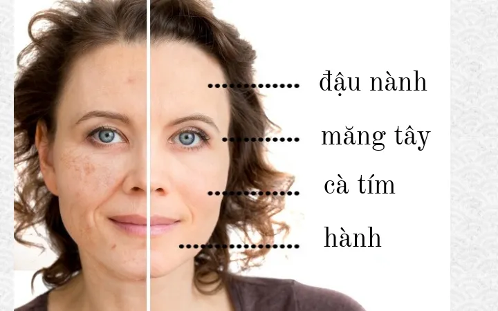 Tìm hiểu chế độ ăn cho từng loại da - Ảnh 2. Tìm hiểu chế độ ăn cho từng loại da - Ảnh 2.