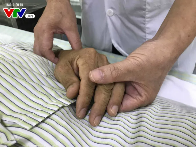 Sai lầm khi tránh nóng mùa hè, nhiều người bị méo miệng, liệt mặt - Ảnh 3. Sai lầm khi tránh nóng mùa hè, nhiều người bị méo miệng, liệt mặt - Ảnh 3.