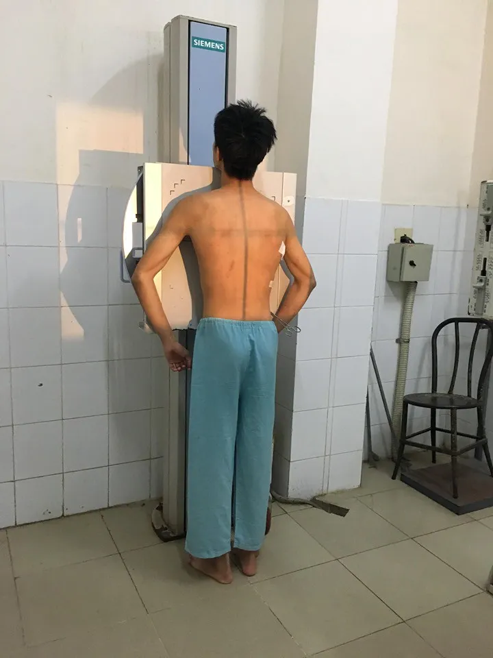 10 ngày ba lần phẫu thuật, nam thanh niên kêu gọi mọi người bỏ thuốc lá - Ảnh 1. 10 ngày ba lần phẫu thuật, nam thanh niên kêu gọi mọi người bỏ thuốc lá - Ảnh 1.