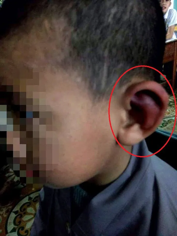 Khởi tố nhà sư bạo hành trẻ 11 tuổi tại Bình Thuận - Ảnh 1. Khởi tố nhà sư bạo hành trẻ 11 tuổi tại Bình Thuận - Ảnh 1.